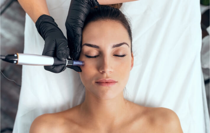 A woman undergoing micro needling at a clinic.